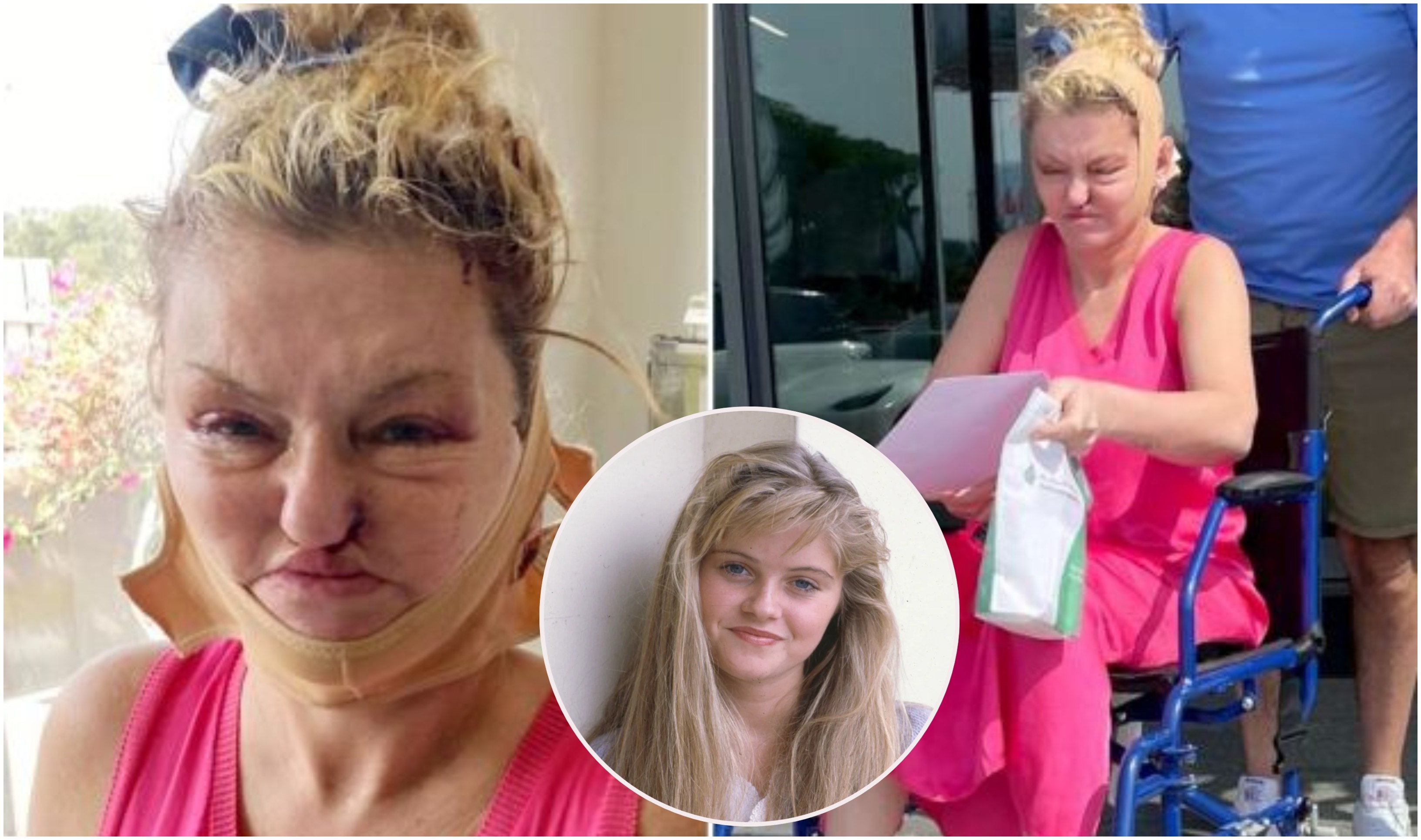 კოკაინმა სახე დაუშალა, ქირურგებმა კი ხელახლა აუწყვეს - დანიელა ვესტბრუკის შოკისმომგვრელი ტრანსფორმაცია